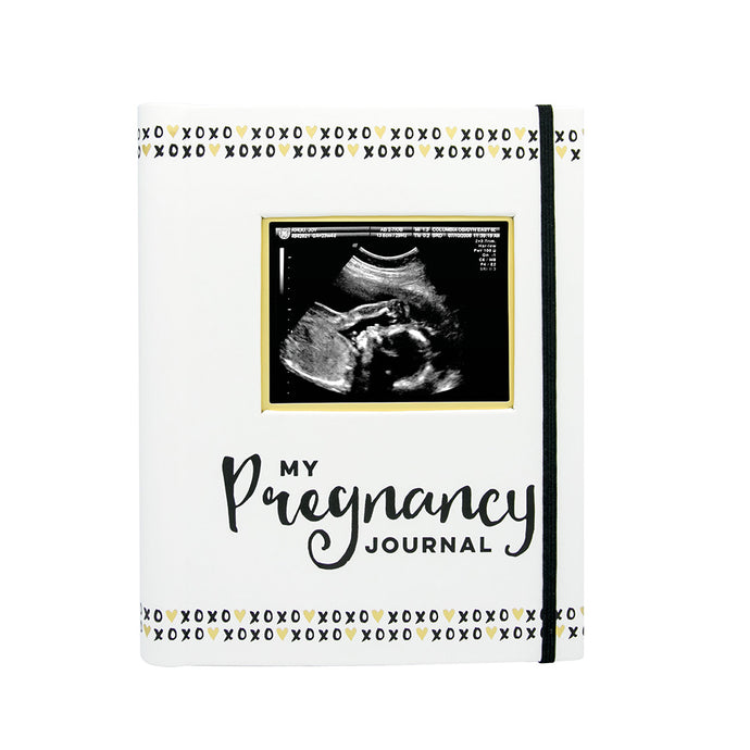 Pregnancy Journal - Black, White & Gold